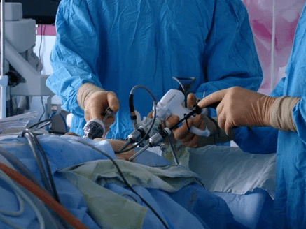 Cerrahi müdahale